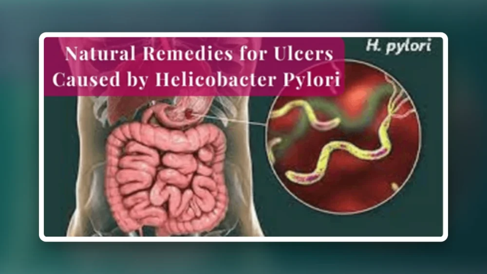 How to Use Natural Remedies for Ulcers Caused by Helicobacter Pylori - Gingivitis Remedy