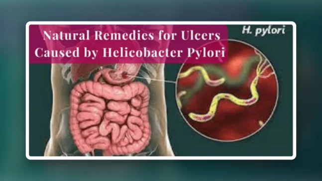 Read more about the article How to Use Natural Remedies for Ulcers Caused by Helicobacter Pylori – Gingivitis Remedy